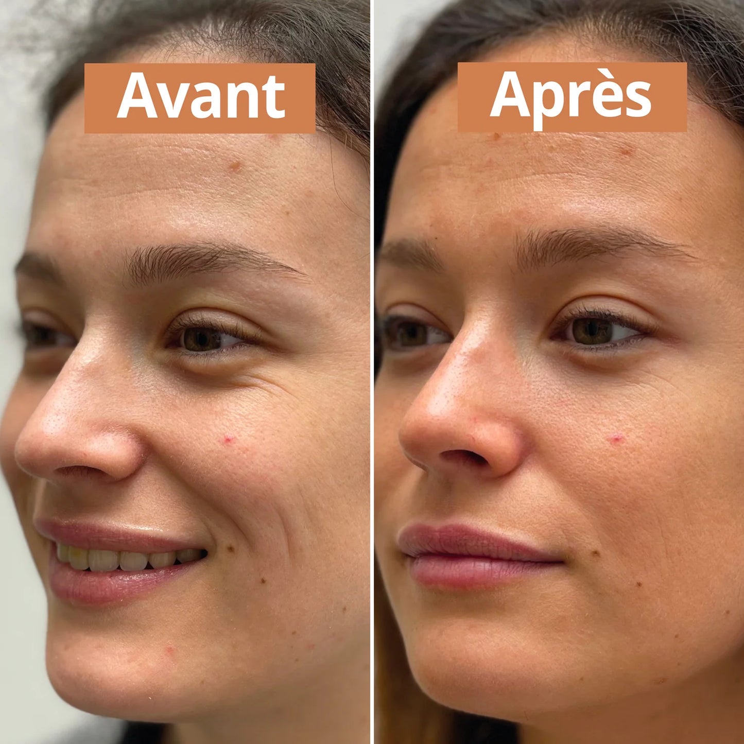 Siero autoabbronzante naturale